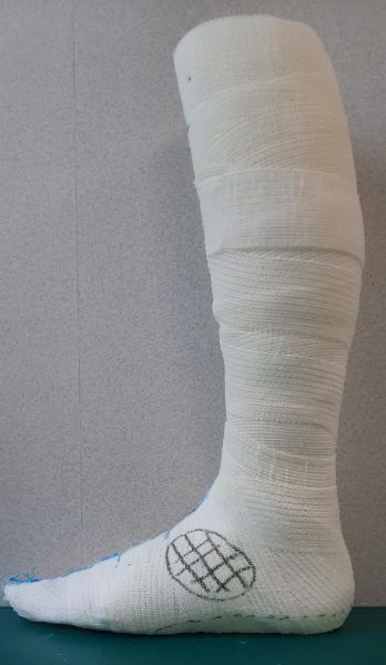 Image de Releveur ALLARD sur moulage